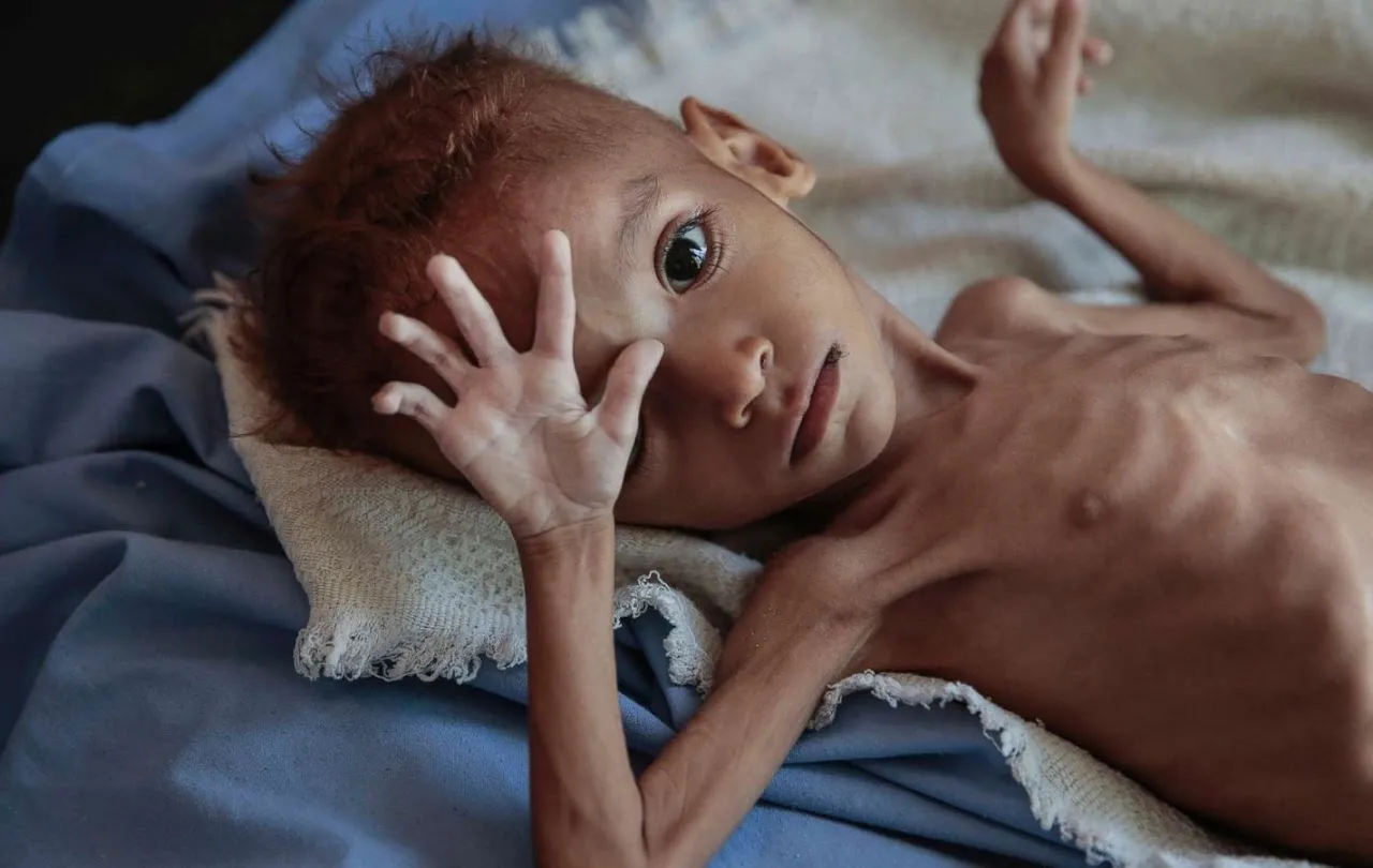 A starving, very thin child