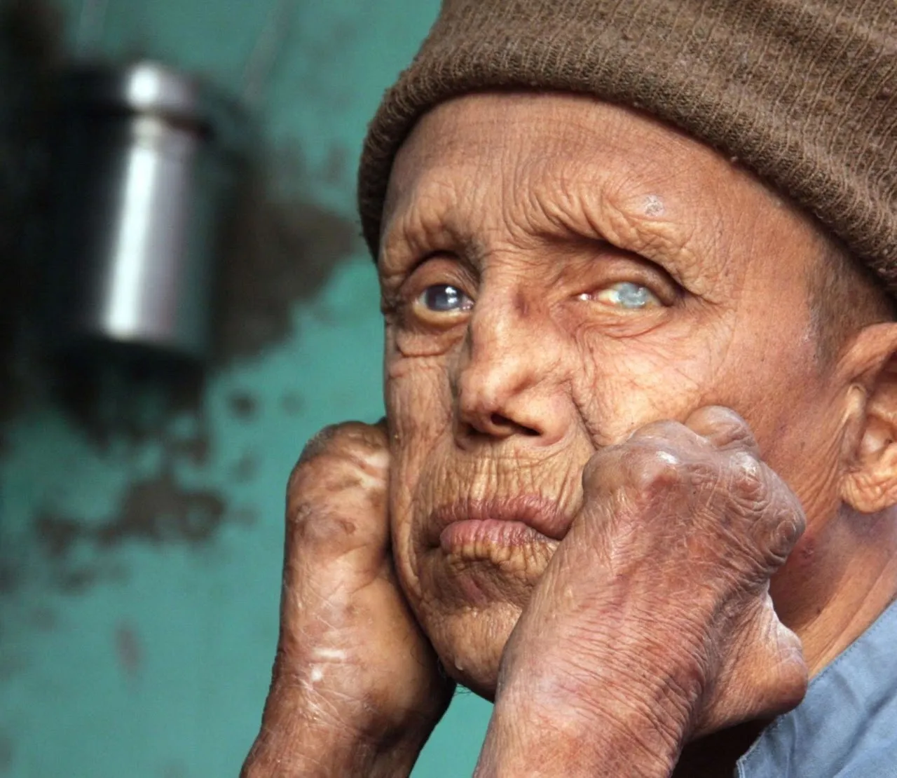 A blind man with a disability
